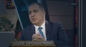 Lazer Liposuction